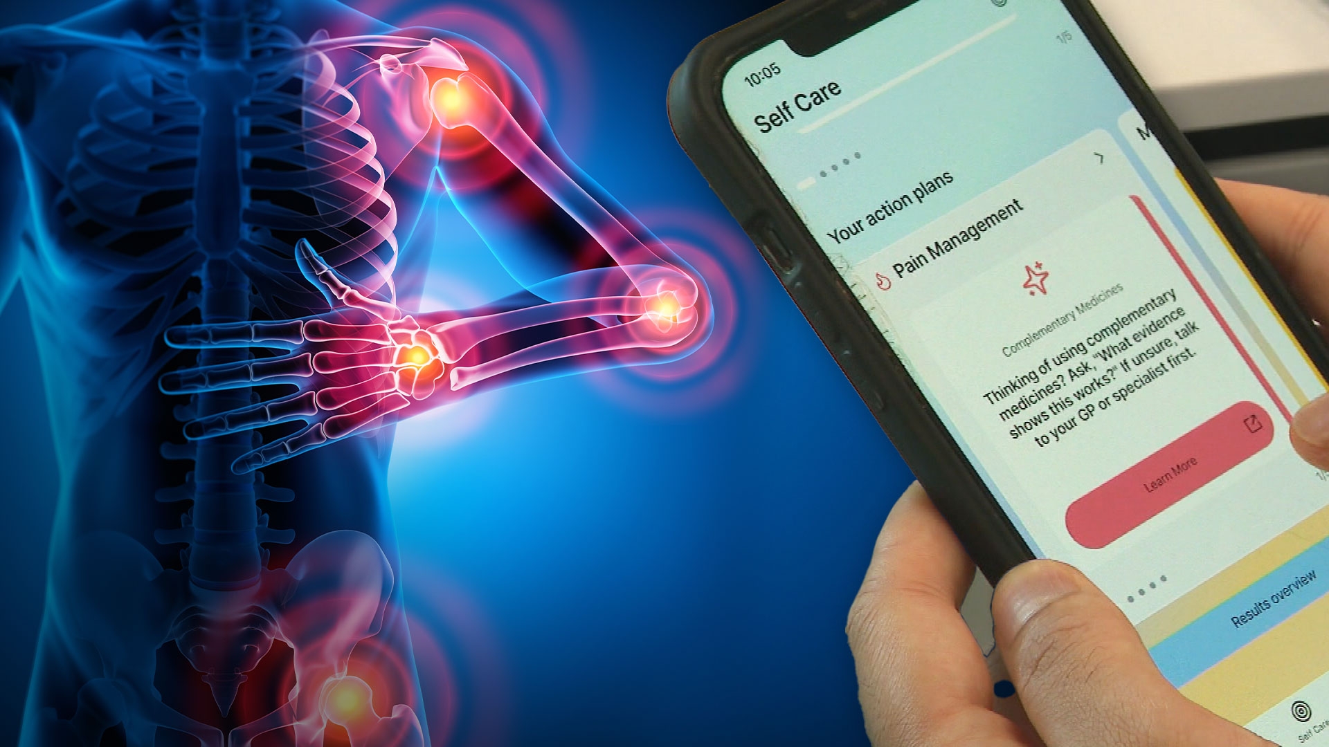 New 'doctor in your pocket' app to ease arthritis patient care