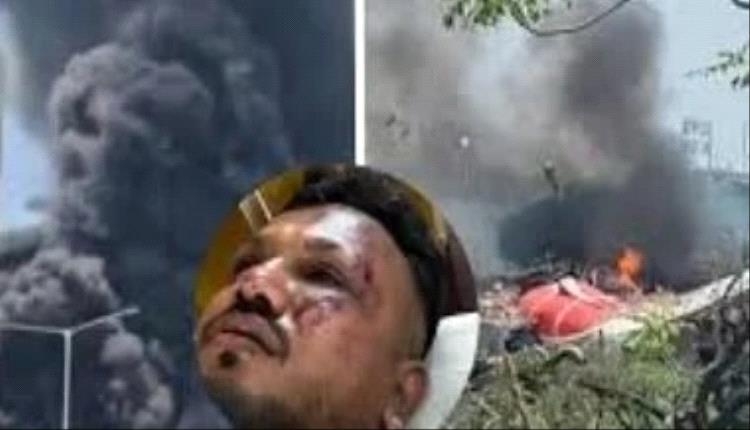 'خرجت من بين الأنقاض'.. الناجي الوحيد من كارثة طائرة الهند يروي لحظات الرعب والموت