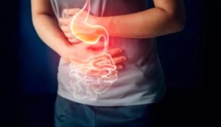 لعلاج حرقة المعدة.. تناول هذه الأعشاب
