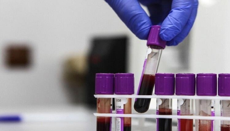 اقوى علاج طبيعي لمنع تكون السرطان في الجسم