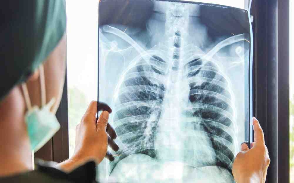 تفوق الذكاء الاصطناعي في تشخيص مرض السل بالموجات فوق الصوتية