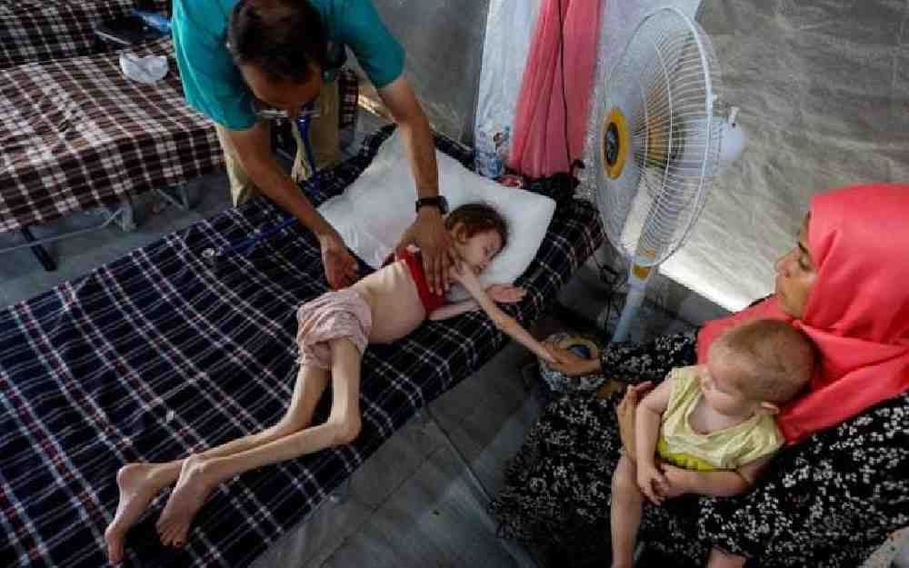 طبيب بريطاني: غزة تواجه همجية من العصور الوسطى ومجاعة مفتعلة