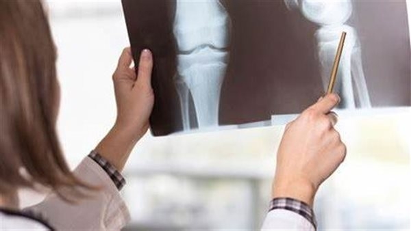 أمل جديد للنساء.. دراسة تقدم طريقة فعالة لدعم صحة العظام