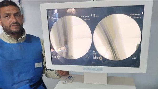 صحة المنوفية: مستشفى زاوية الناعورة يواصل التميز في جراحات العظام وخدمة المرضى