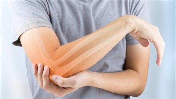 دواء شهير للسكرى يظهر فاعلية فى تخفيف آلالم التهاب مفاصل الركبة
