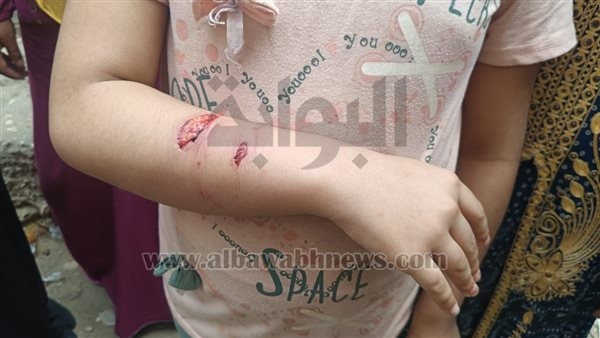 السلعوة تعقر 7 أطفال بحى الصوفى في الفيوم.. صور