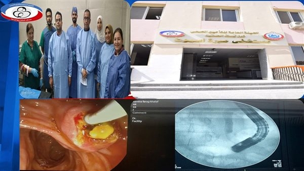 مستشفى مبرة أسيوط تطلق خدمات طبية متقدمة وتُجري أول عملية ERCP