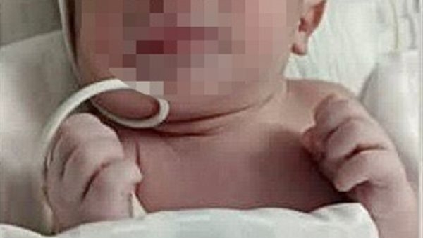 من النار إلى النور.. ولادة الطفل يحيى بمعجزة إلهية في «مستشفى الناس» بعد إصابة الأم بحروق خطيرة