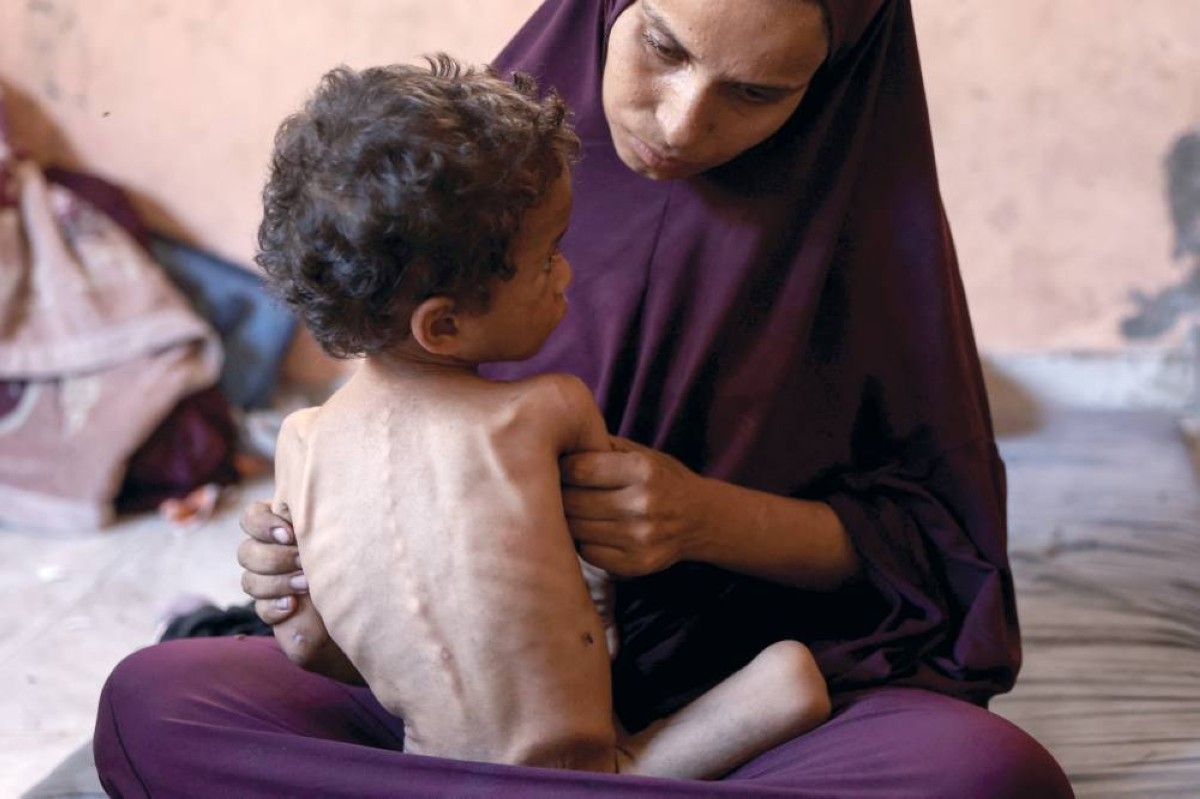 غزة تتضور جوعاً تحت وطأة الحصار