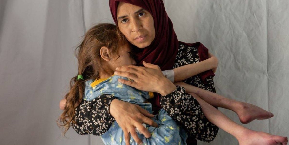 الأمم المتحدة: 100 طفل قضوا جوعاً في غزة