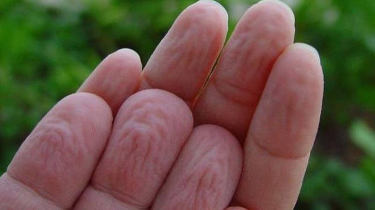 أكثر من مجرد ظاهرة غريبة".. "لماذا تتجعد الأصابع في الماء؟
