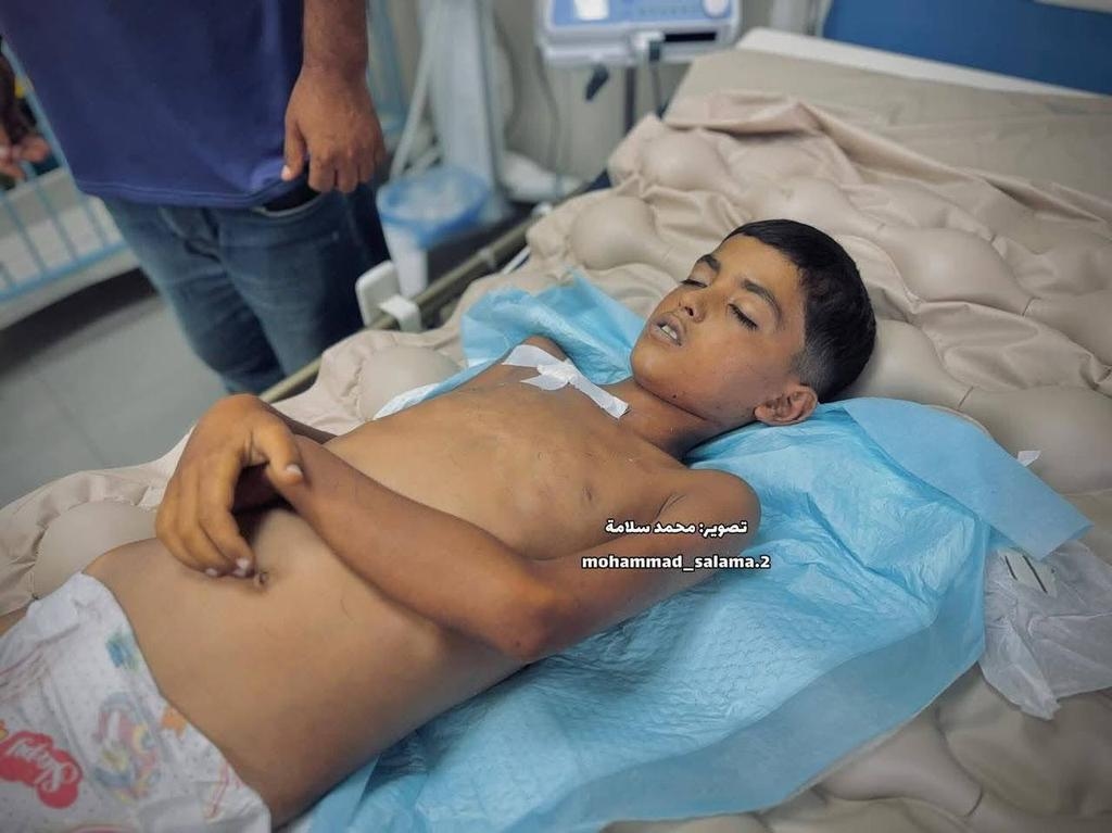 ارتفاع عدد الوفيات بسبب الشلل المتصاعد في غزة إلى 5 بينهم 4 أطفال