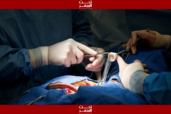 نجاح زرع كلية خنزير معدلة وراثيًا لإنسان !!