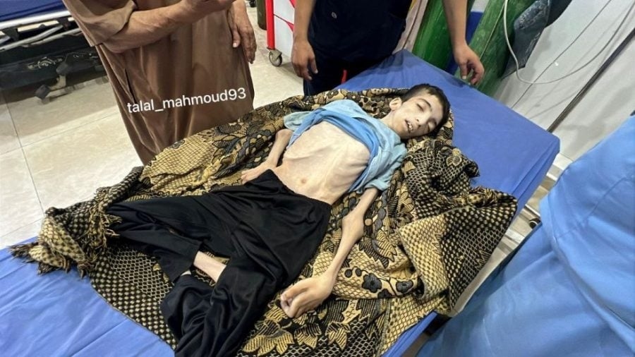 كرم الجمل.. شاب فلسطيني ضحية جديدة لتجويع غزة- (صور)