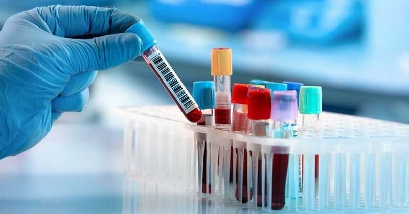 اختبار الذكاء الاصطناعي لكشف الأمراض والعدوى