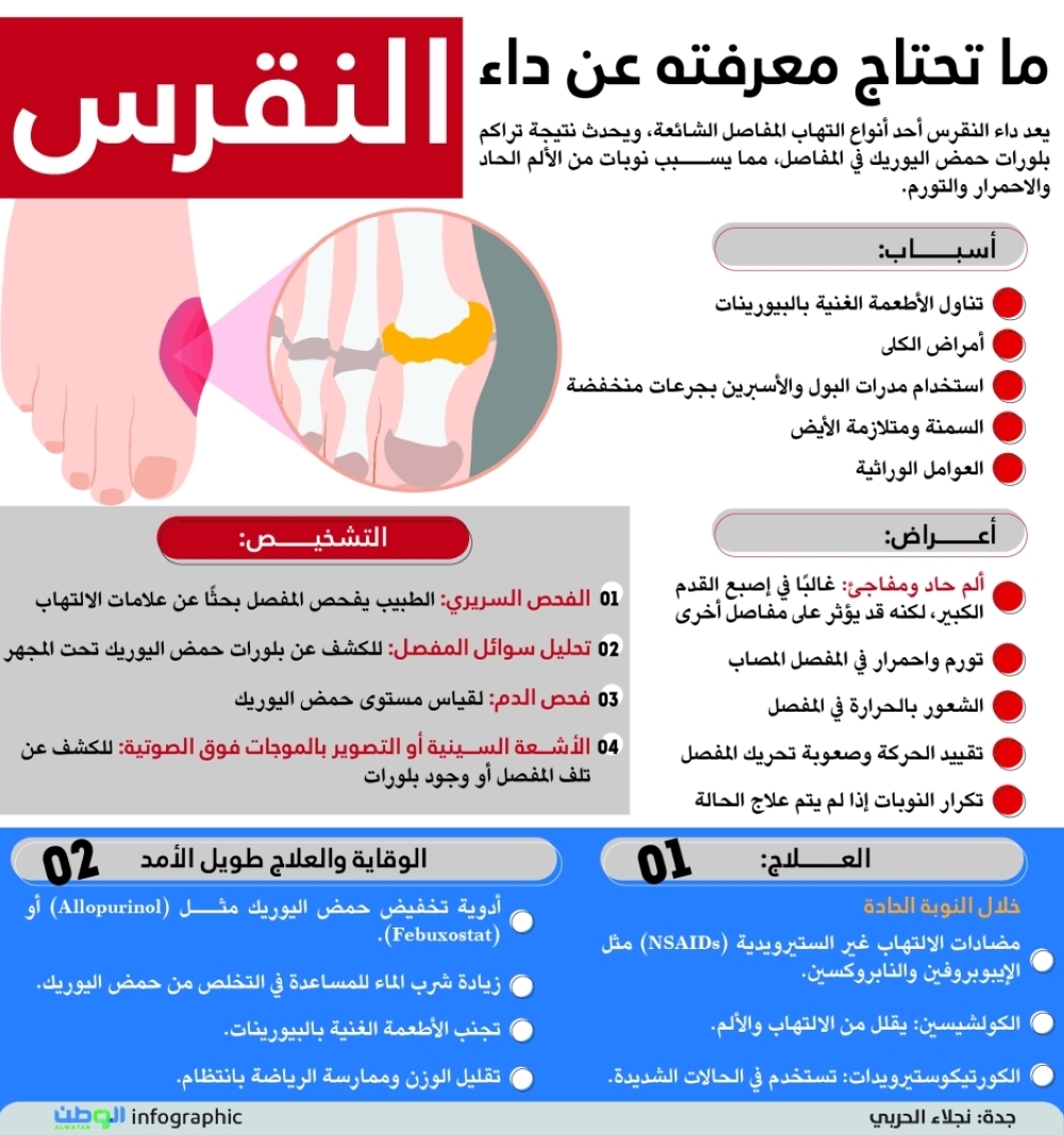 ما تحتاج معرفته عن داء النقرس