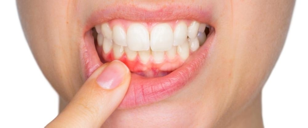 الشباب ضحايا لخدعة تجميل مؤقت بـ7 آلاف ريال