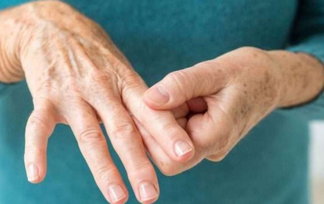 أدوية التخسيس تخفف آلام التهاب المفاصل الروماتويدي