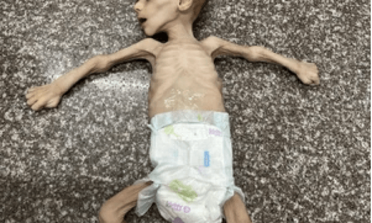 أرواح غزة تُزهَق تحت مقصلة التجويع وتحذيرات من موت جماعي وشيك
