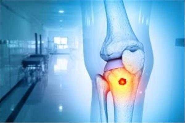 : كيف يُعالج مرض الساركوما؟ إليك 6 طرق مختلفة