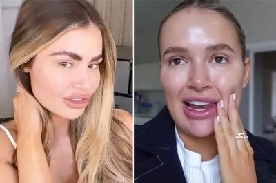 Young people ditch fillers for face-lifts: A growing trend