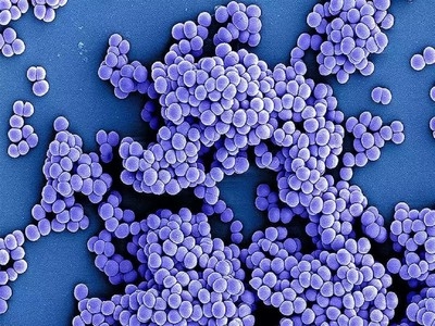 AI solves decade-long superbug mystery in just two days