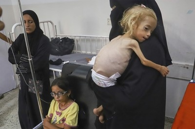 Skeletal Children in Gaza Contradict Netanyahu's ‘No Starvation' Stance