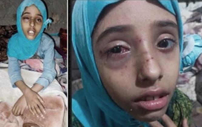 مسن يعتدي بوحشية على طفلة ووالدتها في إب وسط تهديدات بطمس الجريمة