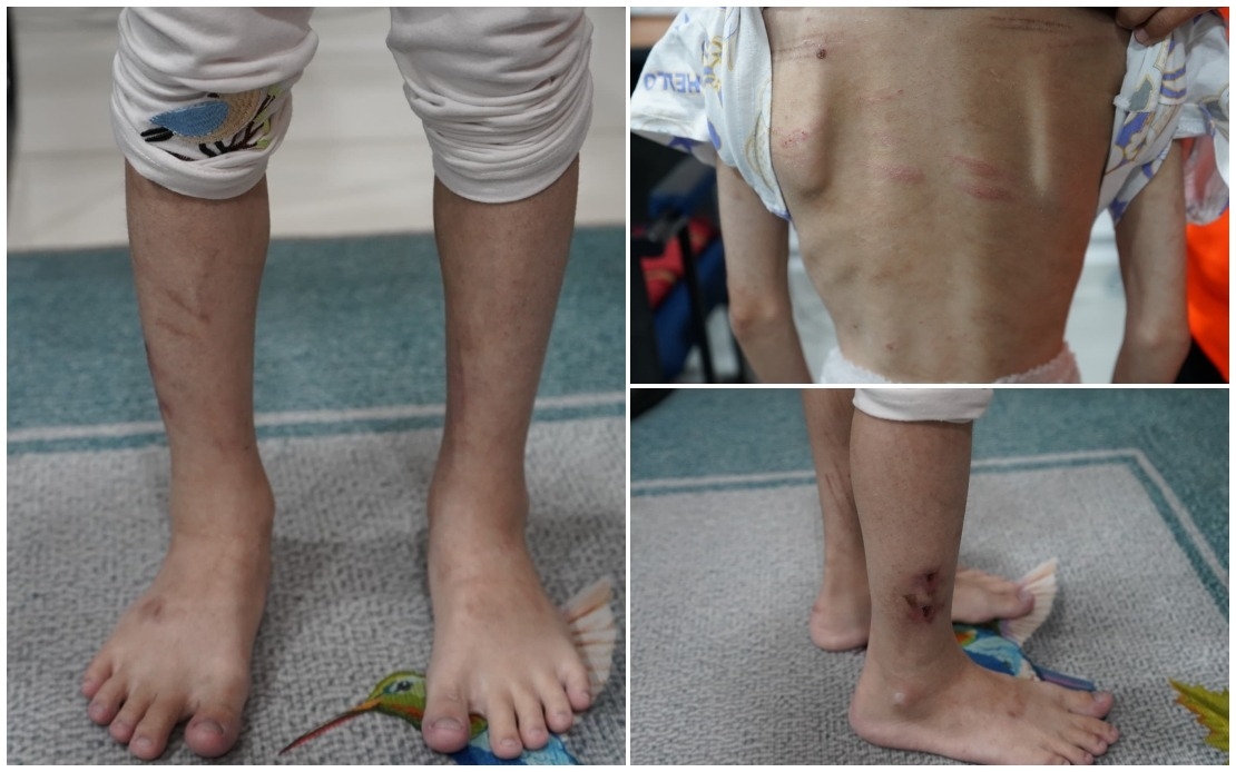 Police Arrest Couple For Allegedly Abusing 11-year-old Daughter