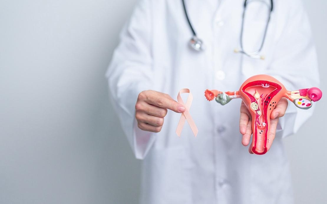 Endometrial Cancer Cases Rising Among Young Women