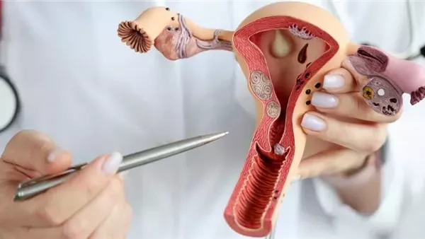 هل يمكن الحمل للمرأة المصابة بتكيس المبايض؟.. طبيب يوضح