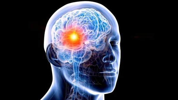 إنفلونزا الدماغ.. ما هي وأعراضها؟