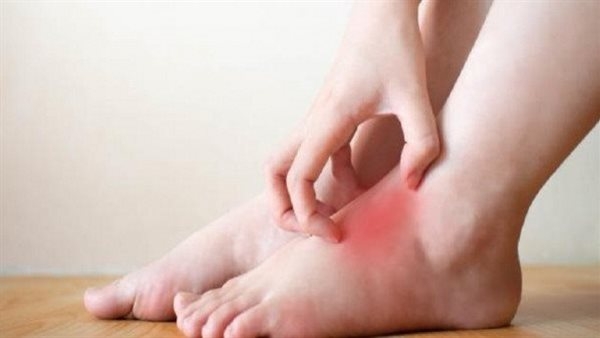 هل يشير الشعور بالحرقان في قدميك إلى مرض السكري أو نقص الفيتامينات؟