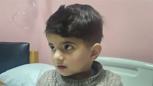 بعد نجاح إجراء أول جراحة قلب مفتوح لطفل من غزة.. ما هي حالة رباعي فالوت؟