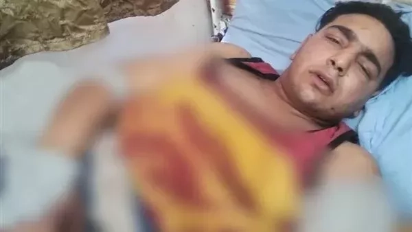بعد واقعة بتر ذراع عامل بسيرك طنطا.. الإفتاء: دية فقد الذراع 50 من الإبل