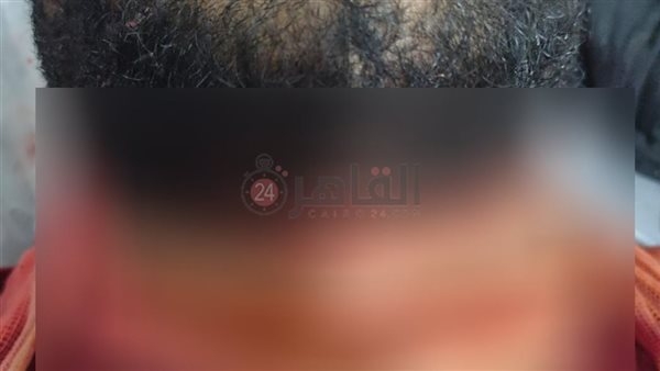 مستشفى الفيوم العام: استقرار الحالة الصحية لعامل محل الكشري المصاب بجرح في الرقبة
