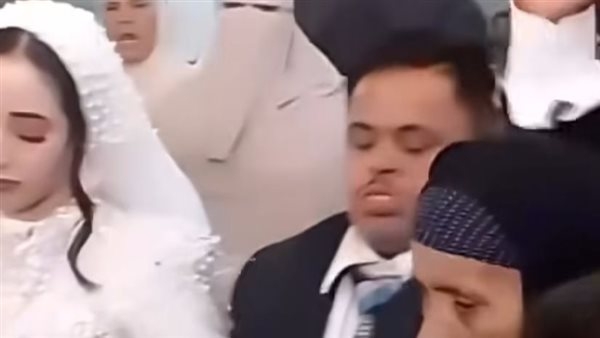 فيديو زفاف عريس من أصحاب متلازمة داون يثير جدل السوشيال ميديا