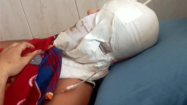 شقيقة طالب جامعي بالشرقية تكشف تفاصيل اعتداء شابين عليه: كسروا جمجمته وصفوا عينه علشان قالهم صلحوا التوك توك