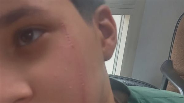 15 يوليو.. جلسة معارضة والد الصغير المتهم بالتعدي على زميله أمام مدرسة بالبدرشين ضد حبسه