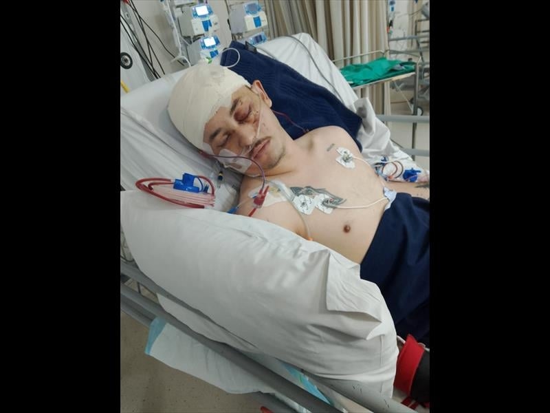 Help Uvongo's Ruan recover from accident injuries