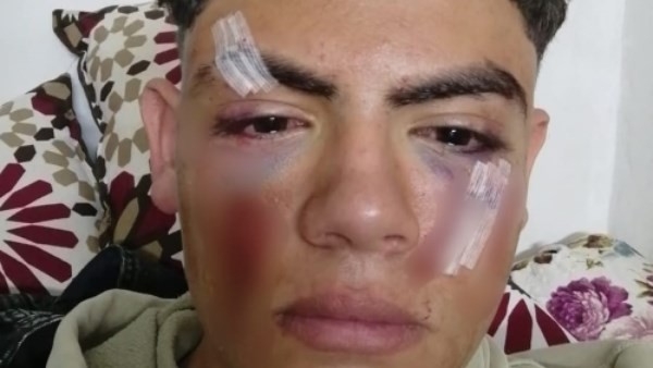 ضيعوا مستقبله بسبب شهامته.. كواليس سحل لاعب كونغ فو ومنعه من اللحاق بالمنتخب
