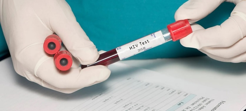 HIV cases among teens as young as 13 years