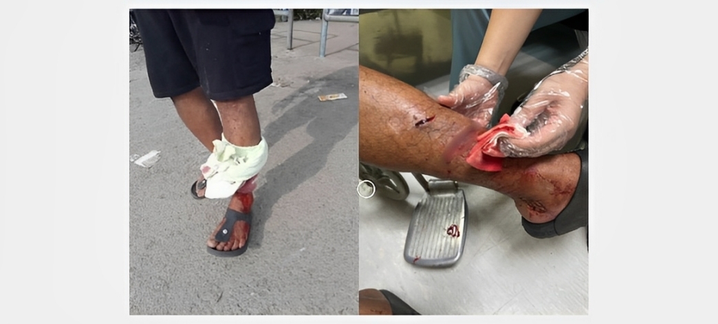 Fears of wild monkey attacks grip Lahad Datu folks