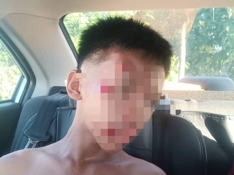Teen injured after fall during wild dog chase in Lahad Datu