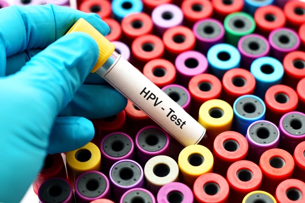 Over 10,500 women in Malaysia tested HPV-positive