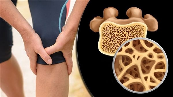 ابتكار علمي يحوّل البول إلى مادة لزراعة العظام والأسنان