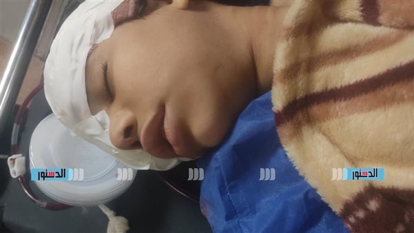 فقدت عينيها ونزيف بالمخ.. كواليس معاناة طفلة من ذوى الهمم خلال رحلة علاج بقطار المنوفية