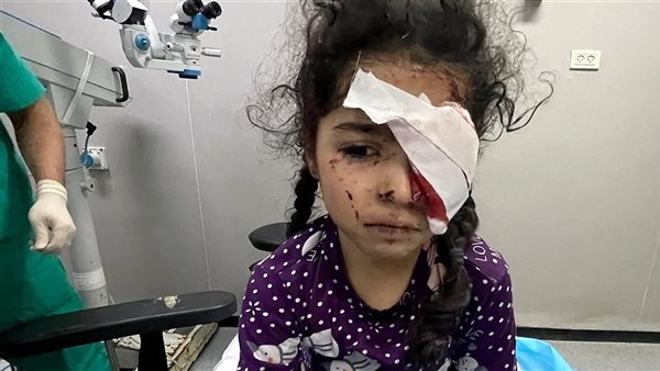 "صحة غزة": 1500 فلسطينى فقدوا البصر و4000 مهددون بفقدانه بسبب الحرب