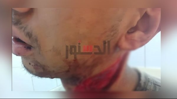 طالب يعتدي على زميله بـ"كتر" في المحلة الكبرى والأمن يضبط المتهم