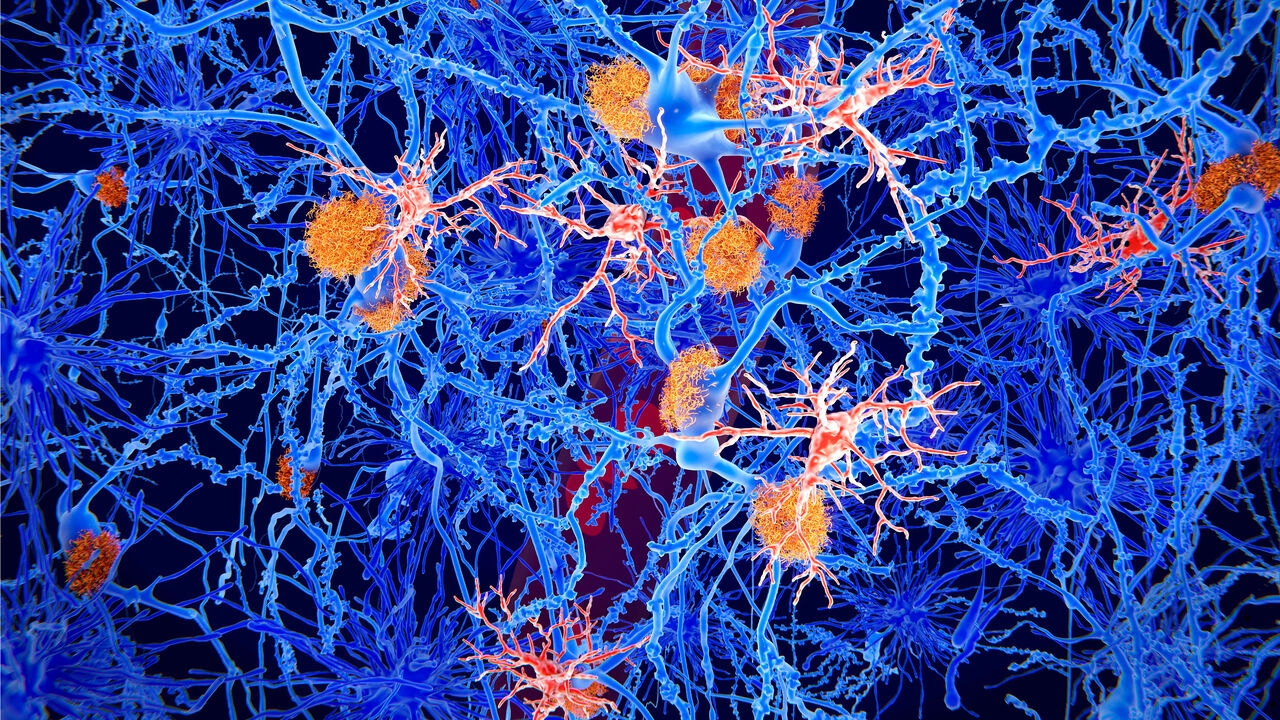 The Alzheimer's drug pipeline is healthier than you might think